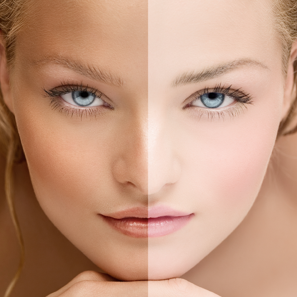 PAT THERMAL THALOXOTERM PRESTIGE 